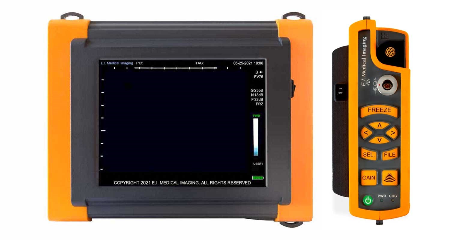 IBEX SuperLite HR直肠探头版
